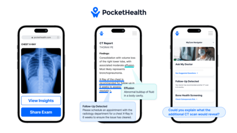 PocketHealth eases doctor-patient communications with easy image exchange